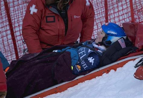 Mikaela Shiffrin Shares Graphic Image of Her Injury from。